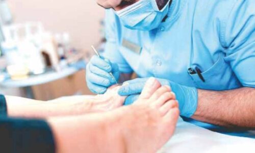 Prevención en pie diabético4